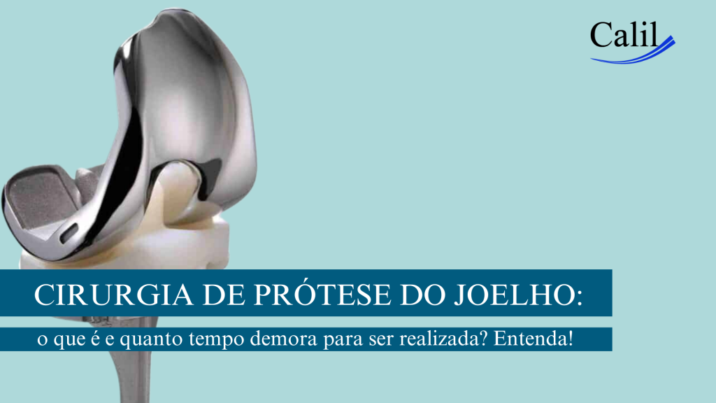 Cirurgia de prótese do joelho: o que é e quanto tempo demora para ser realizada? Entenda!