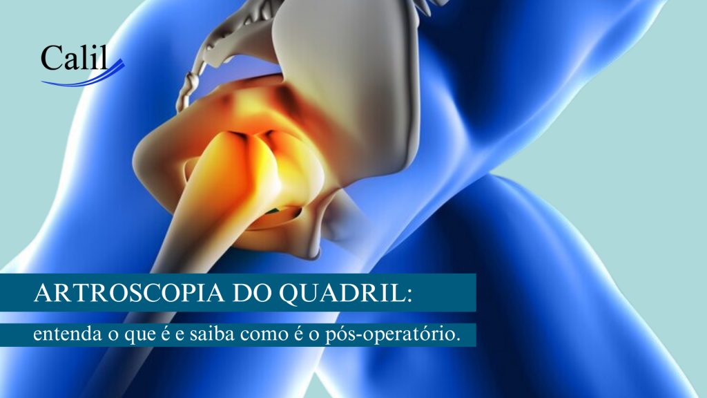 Artroscopia do quadril