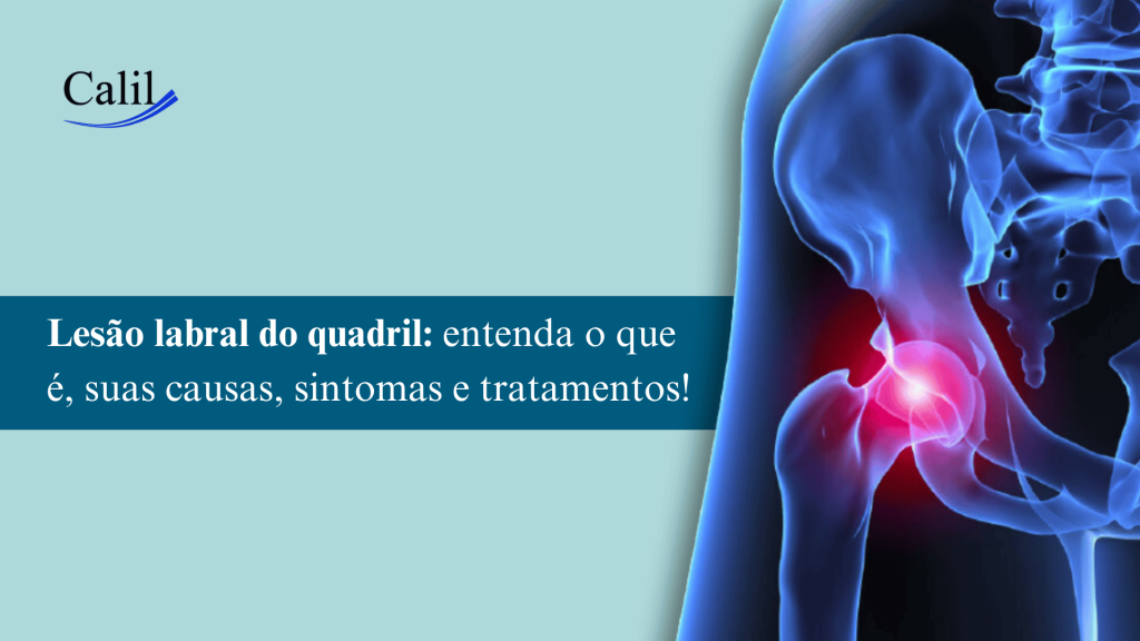 Lesão labral do quadril