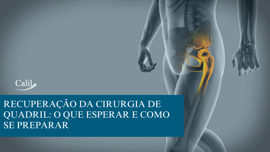 Cirurgia do quadril