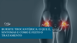 Bursite trocantérica
