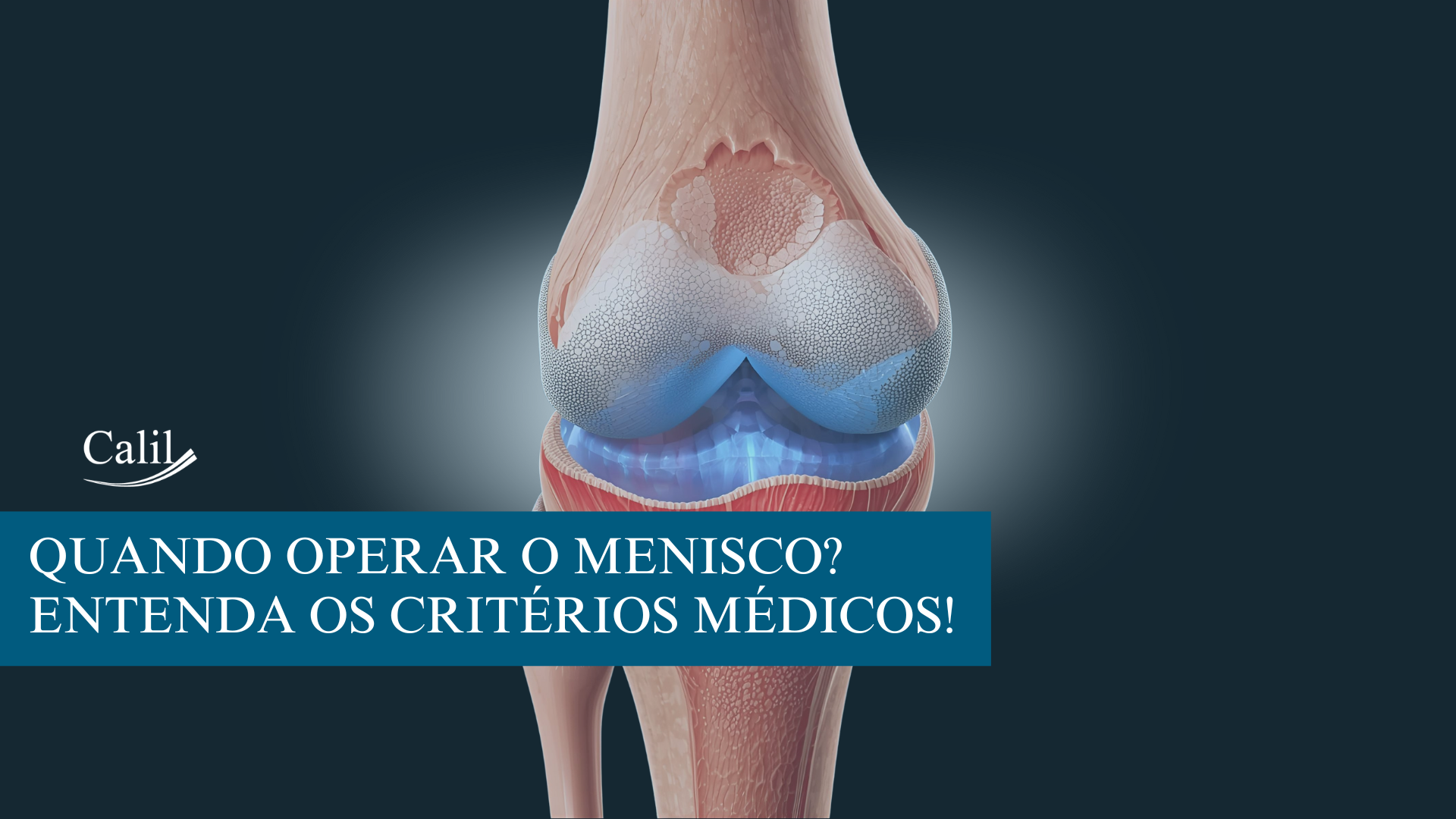 Quando operar o menisco