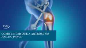 Artrose no joelho