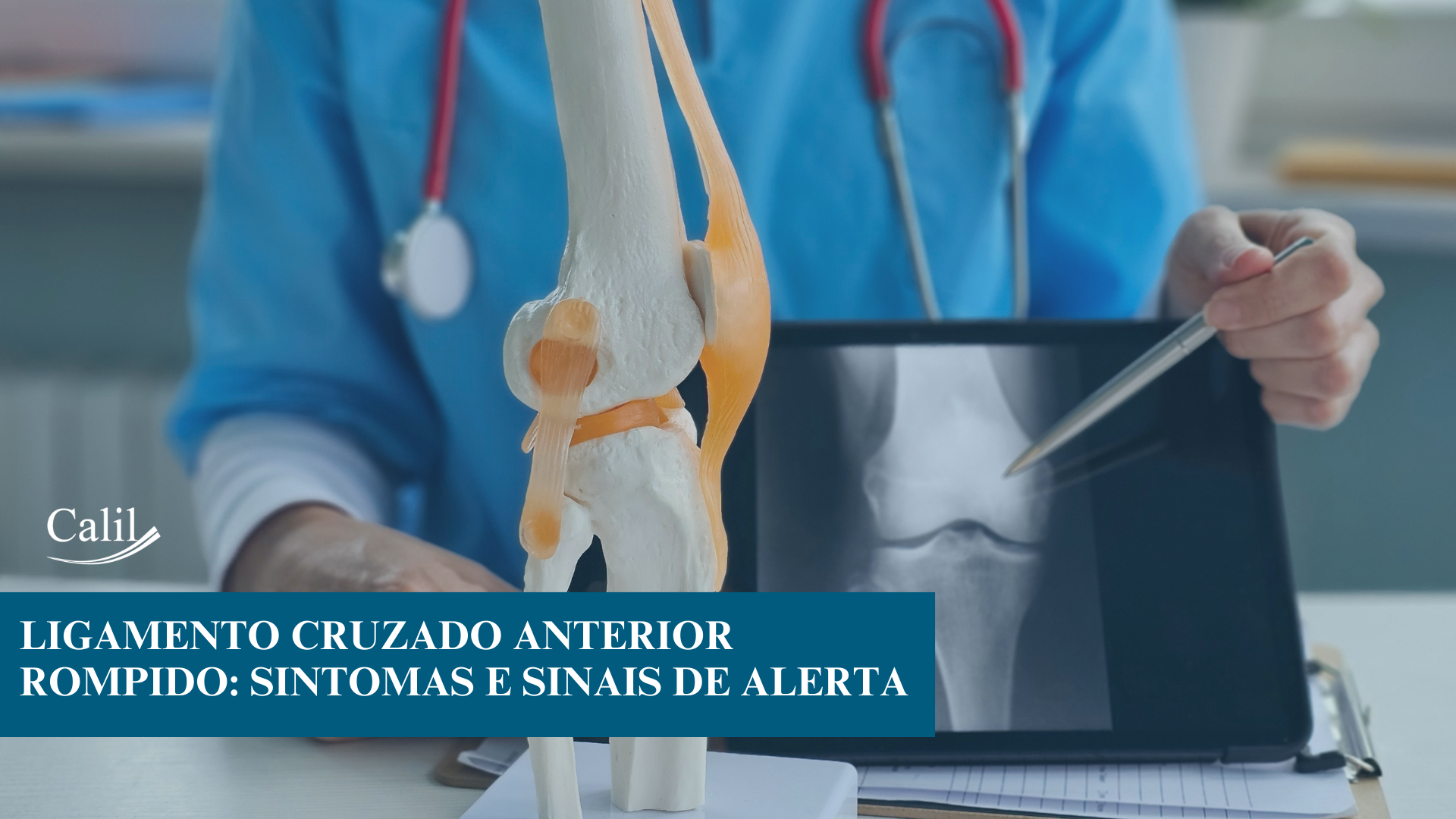 Ligamento Cruzado Anterior